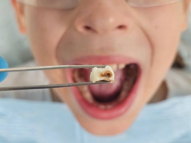 Best Cosmetic Emergency Dentistry in Medina, TN